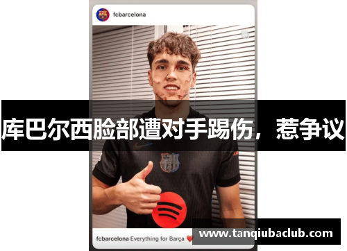 库巴尔西脸部遭对手踢伤,惹争议 库巴尔西脸部遭对手踢伤,惹争议